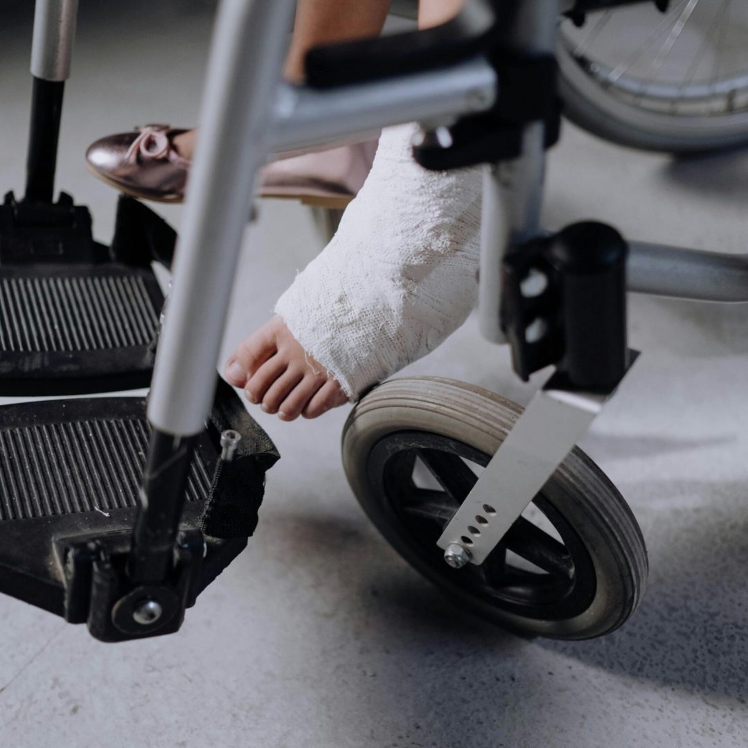 Close-up of an injured foot in a cast resting on a wheelchair, indoors.
